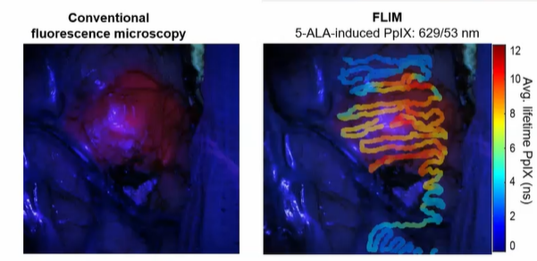 Exploring the Future (and Past) of Biomedical Imaging at the 2022 Biophotonics Congress